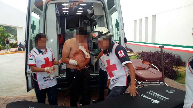 Investigan agresión armada contra siete personas en Acapulco Investigan agresión armada contra siete personas en Acapulco